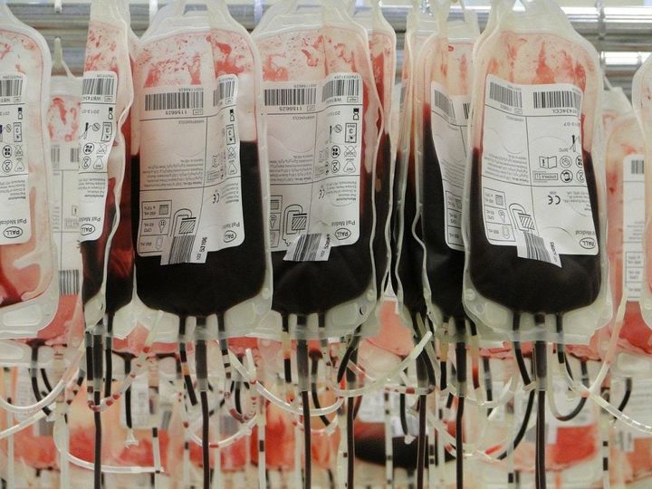 krv-zavod-transfuzija.jpg